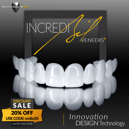 IncrediBIL Veneers™